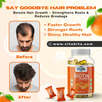 Vitabitz Biotin 3 in 1 Gummies